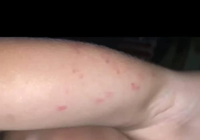 Polícia investiga suspeita de agressão a aluno em escola infantil de Espumoso; professora é afastada