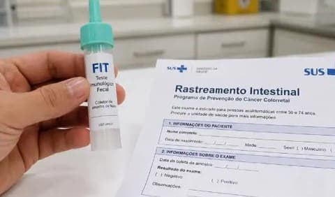 SUS começa a distribuir testes para rastreamento do câncer de intestino