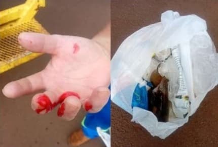 Gari fica ferido após descarte irregular de vidro em Santo Augusto e Prefeitura faz alerta à população